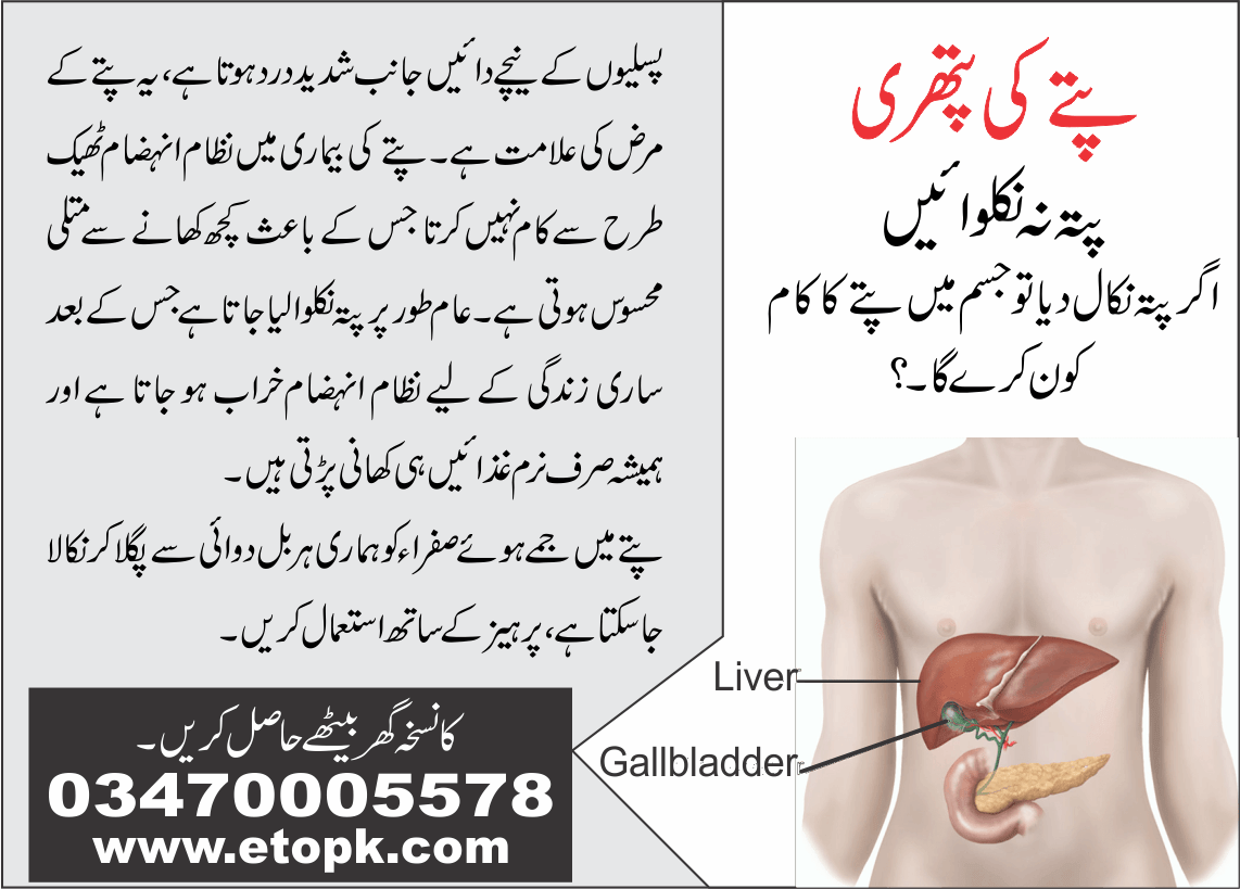 پتے کی پتھری